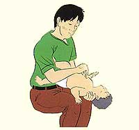 Minh họa CPR cho trẻ sơ sinh